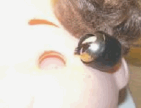 �l�`�̖ڋʊO�ςƖڂ̑傫����r